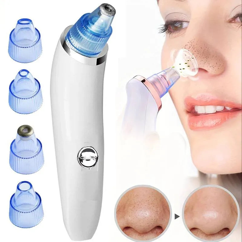 Blackhead Removal Machine 4 in 1 Black Head Remover Machine